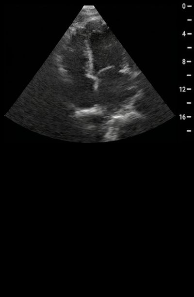 B-Mode Baseline